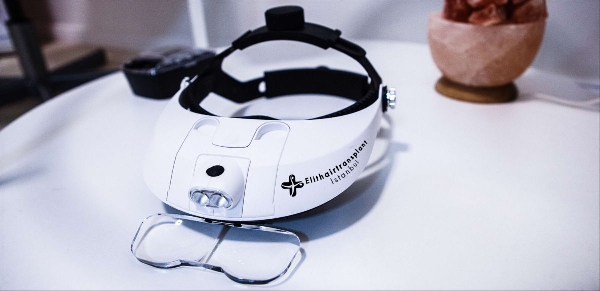 Haartransplantation – wie viele Grafts sind möglich?