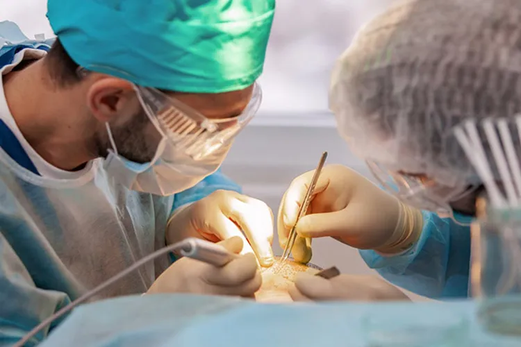 Haartransplantation Eingriff mit der FUE-Technik – Entnahme einzelner Haarfollikel im Spenderbereich