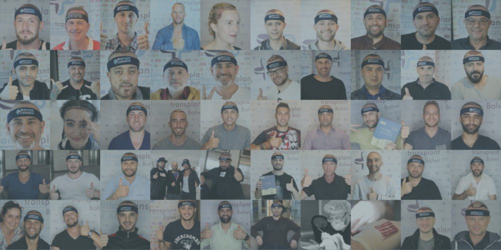 Haartansplantation Türkei Testsieger