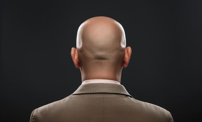 Eine Glatze ist sexy – Unsinn oder Wahrheit - Glatzer Mann von hinten
