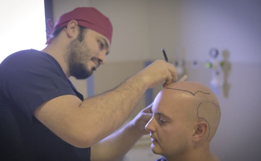 Glazen Simulator - Dr Balwi zeichnet Haarlinie vor Behandlung