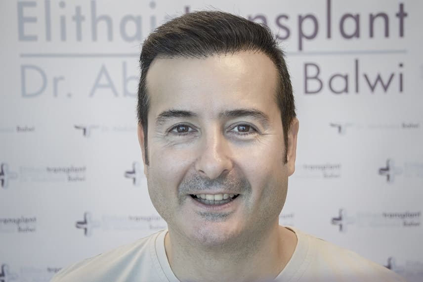 Regeneration der Haare Junge Mann nach der HT Elithairtransplant