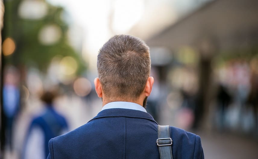 Haartransplantation ohne Eigenhaar