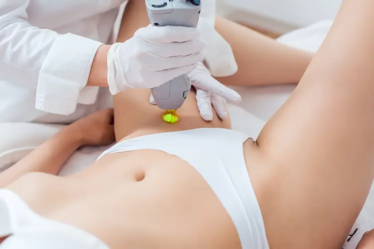 Frau auf einer Patientenliege bekommt eine Laserbehandlung im Intimbereich