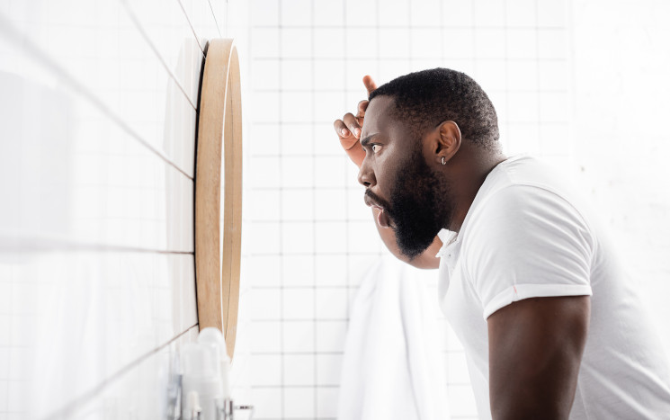 Mann checkt nach Haartransplantation Afro Haare