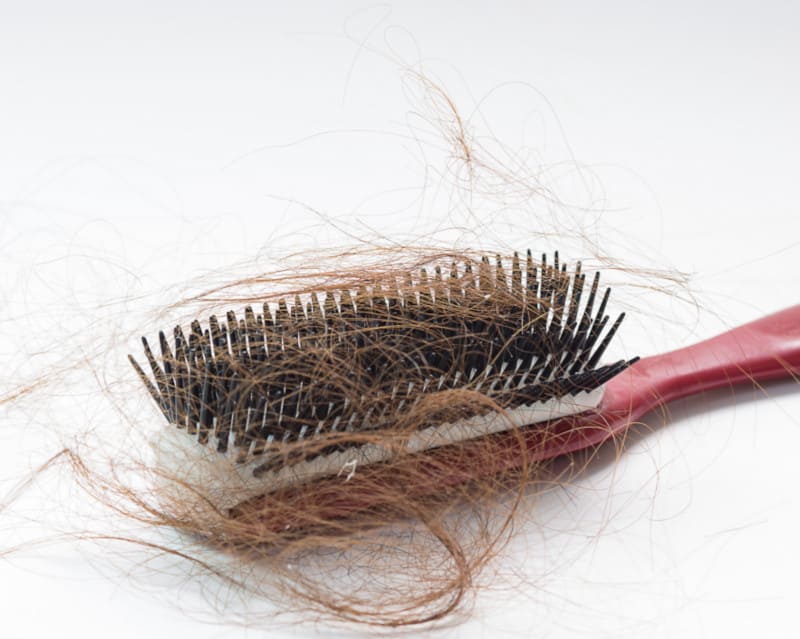 Arten von Haarausfall