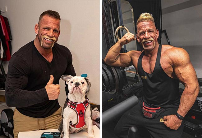 Nachher DHI Haartransplantation mit 2900 Grafts von Patient Hollywood Matze