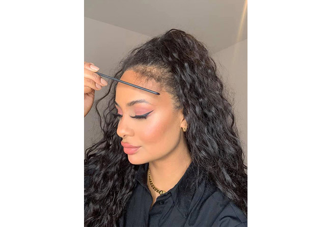 Vorher nachher SDHI Haartransplantation mit 3200 Grafts bei Patientin Jahy C nach 2 Monaten