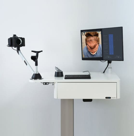 Der Elit-Scanner für die Haartransplantation in Stuttgart