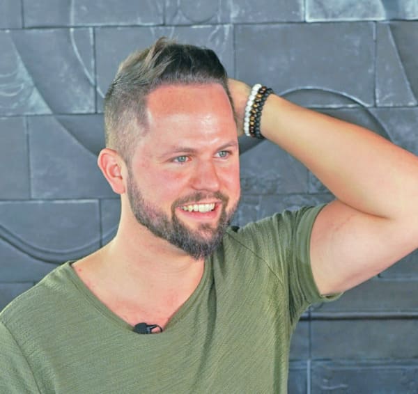 Patient Nico nach der Haartransplantation in Frankfurt