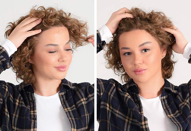 Nachher Saphir Haartransplantation mit 2600 Grafts von Patientin Lilianna Steinhöffel