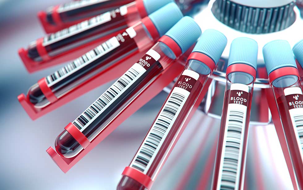 Röhrchen mit Blut bei der Analyse