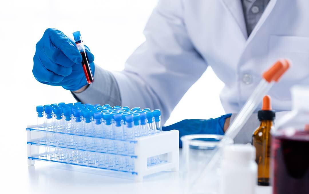 Arzt führt Blutanalyse durch für das Pre-Test-System