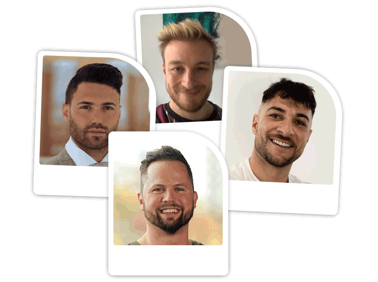 Gif für die Haartransplantation Erfahrungen der Patienten