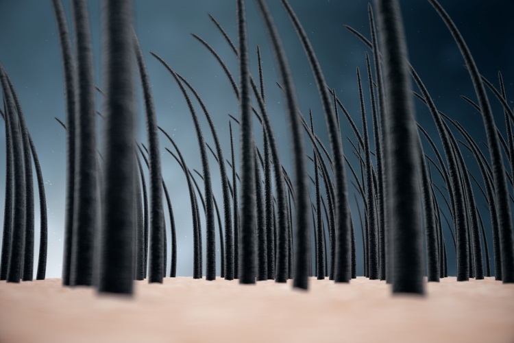 Mehrere Haarwurzeln in der Haut