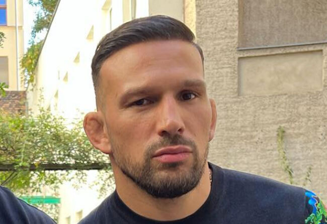 Nachher DHI Haartransplantation mit 3250 Grafts bei Patient Max Coga