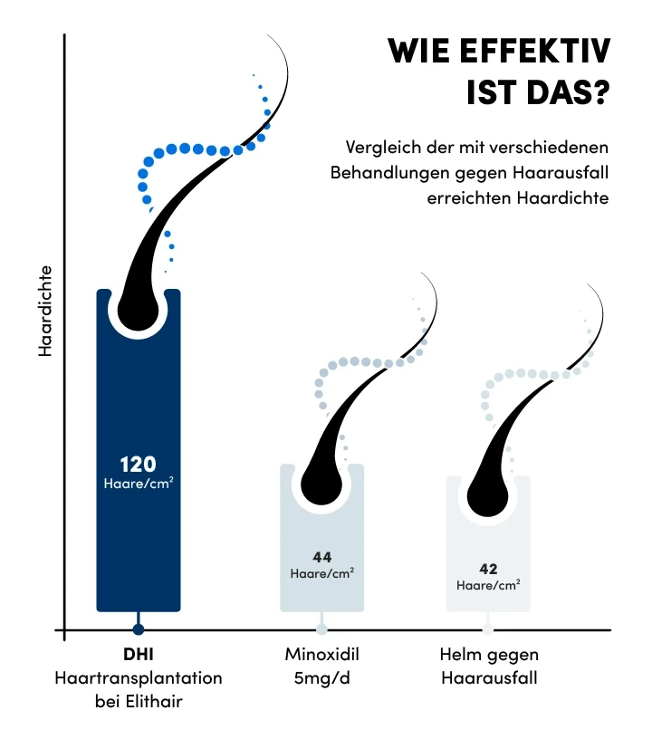 Infografik zur Haardichte anhand von drei verschiedenen Haarbehandlungen gegen Haarausfall