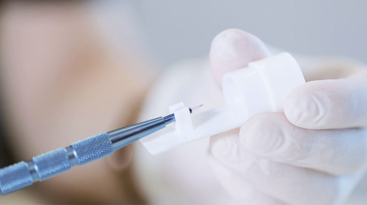 Saphir Haartransplantation Instrument für die V-förmige Kanalöffnung