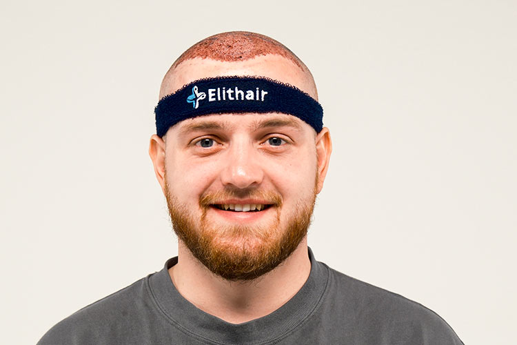 Trymacs zufrieden und lächelnd nach der Haartransplantation bei Elithair