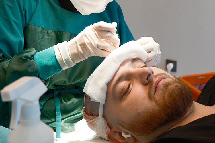 Elithair-Spezialisten führen die DHI Haartransplantation bei trymacs durch