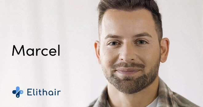 Thumbnail des Testimonal Video von Patient Marcel für die Haartransplantation in der Türkei