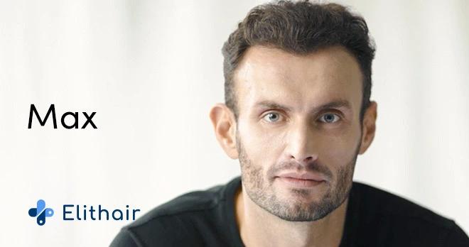 Thumbnail des Testimonal Video von Patient Max für die Haartransplantation in der Türkei