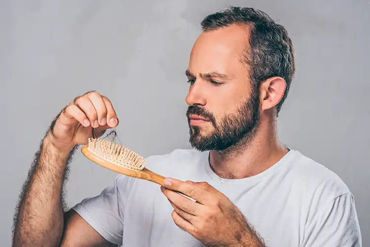 Ein Mann hält eine Haarbürste und entdeckt dort seine Haare, da er Haarausfall hat