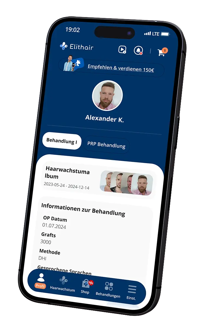 Der Startbildschirm der Elithair App für die Haartansplantation