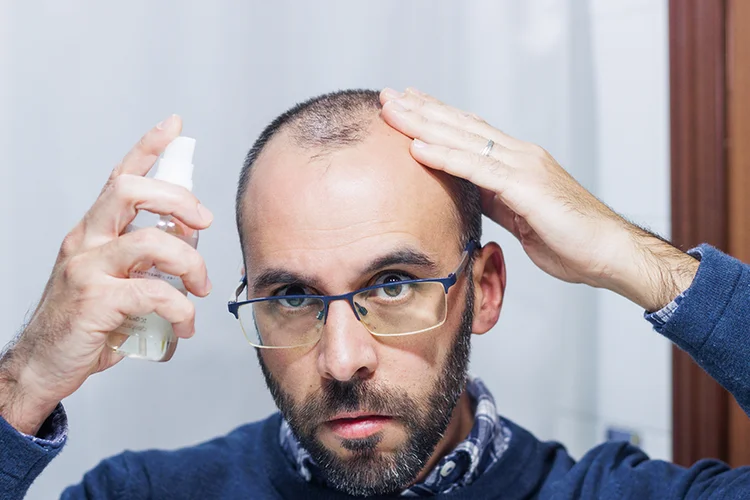 Ein Mann mit sehr lichtem Haar benutzt eine Sprühflasche und blickt besorgt – steht sinnbildlich für den Versuch, Haarausfall mit Produkten selbst zu behandeln.