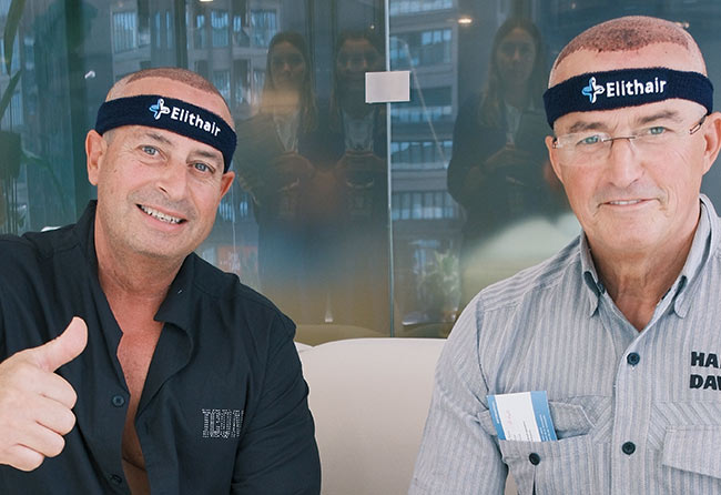 Zufriedene Elithair Patienten nach der Haartransplantation