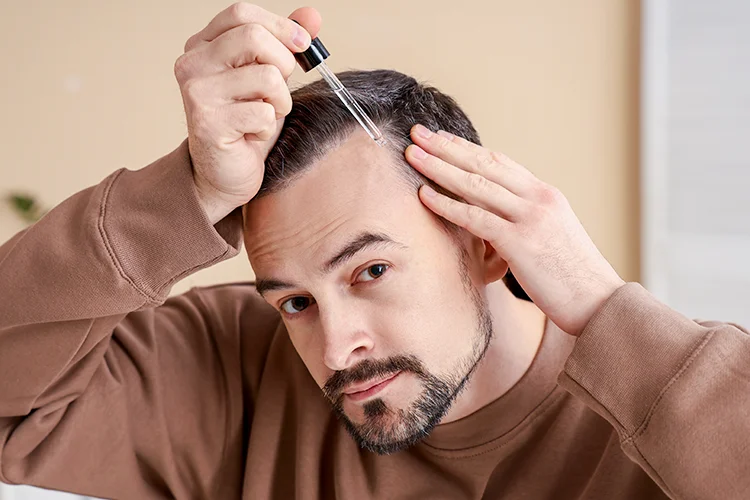 Mann trägt ein Serum mit einer Pipette auf die Kopfhaut im Bereich der Haarlinie auf