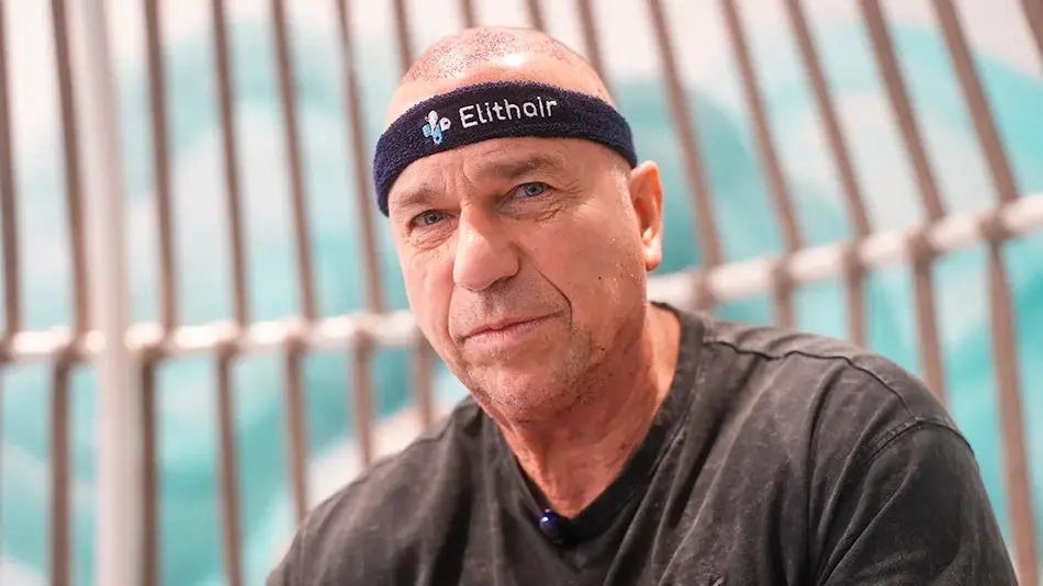 Bild zeigt eine Nahaufnahme von Kai Ebel nach seiner Haartransplantation bei Elithair