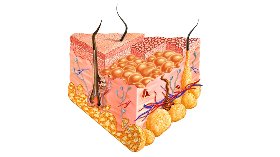 Medizinische Illustration eines Haarfollikels mit Blutgefäßen und Nerven im Hautquerschnitt 
