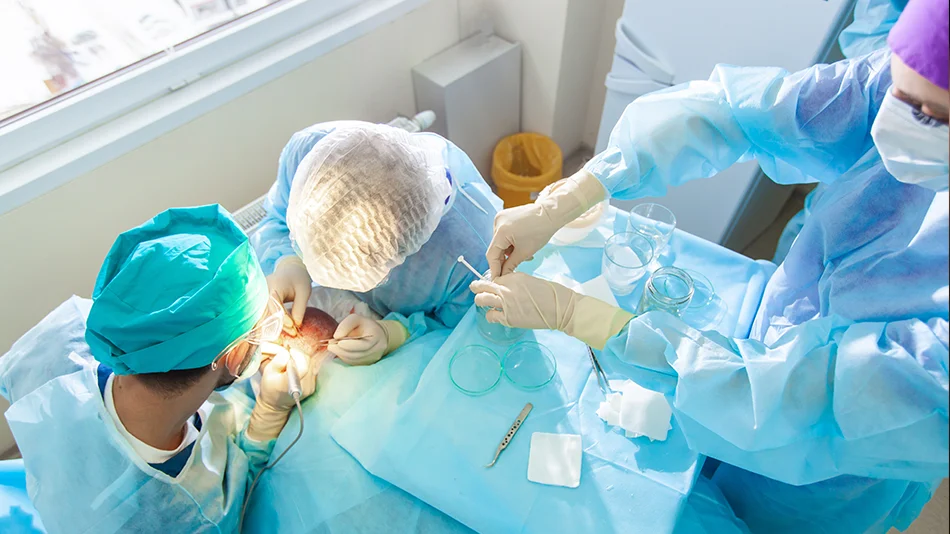 Ärzteteam führt eine Haartransplantation im OP durch, Blick von oben auf die Kopfhaut des Patienten