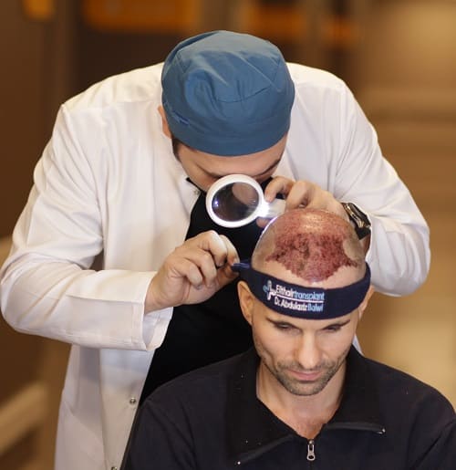 Die ersten Tage nach der Haarimplantation Nachsorge